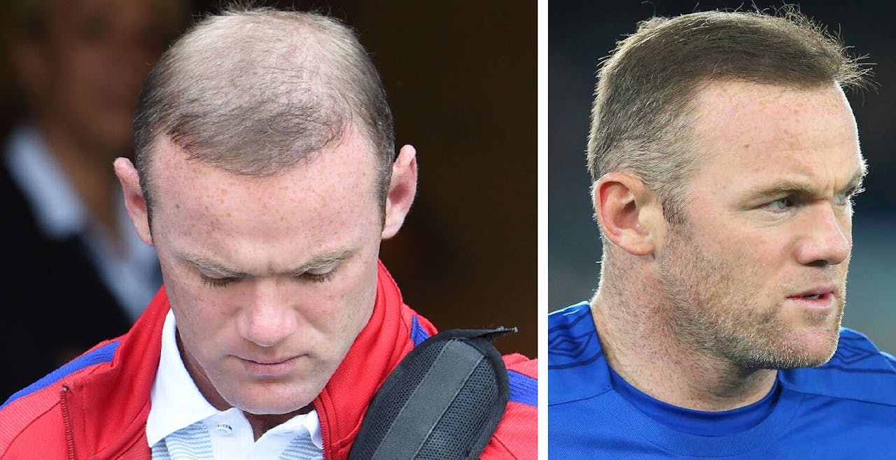 Wayne Rooney pelo