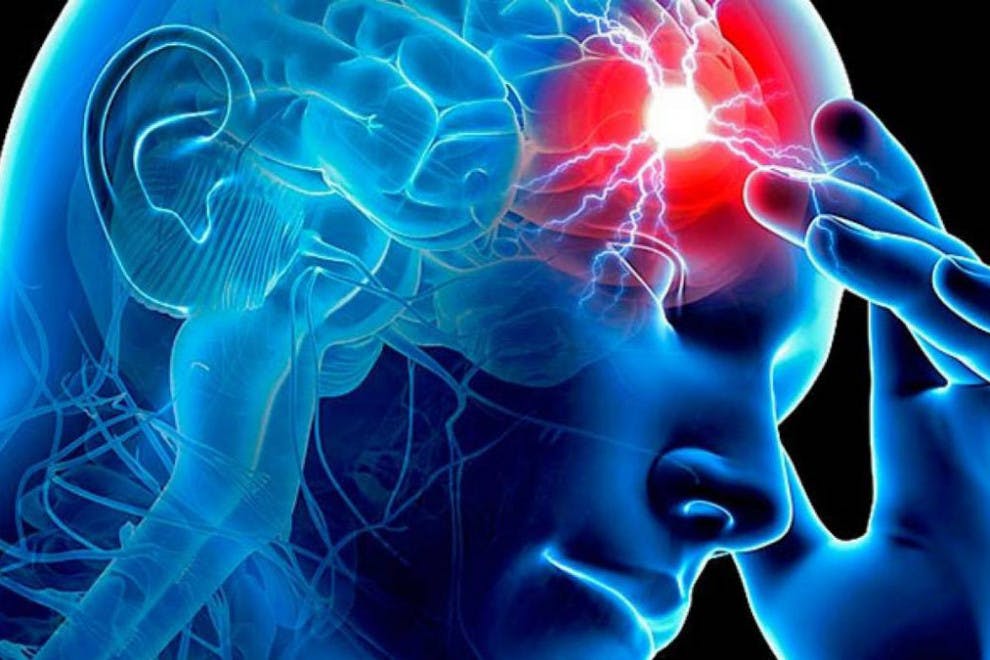 Causas y síntomas de la isquemia cerebral