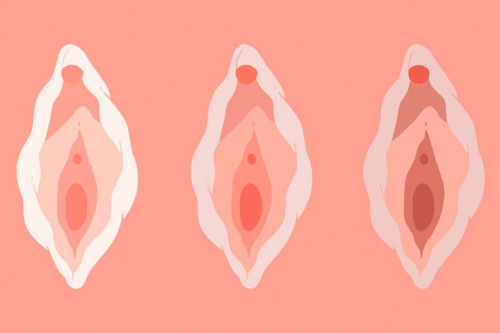 tipos-vulvas